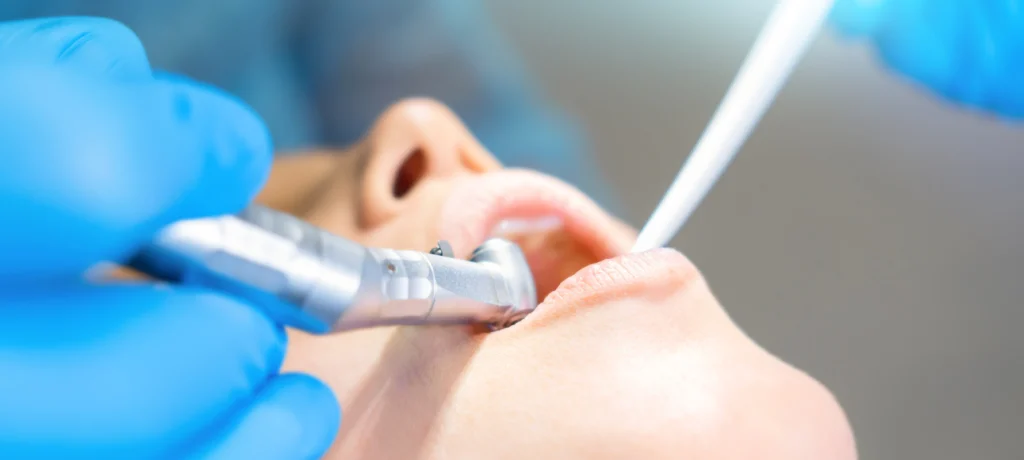 Conseils post-opératoires