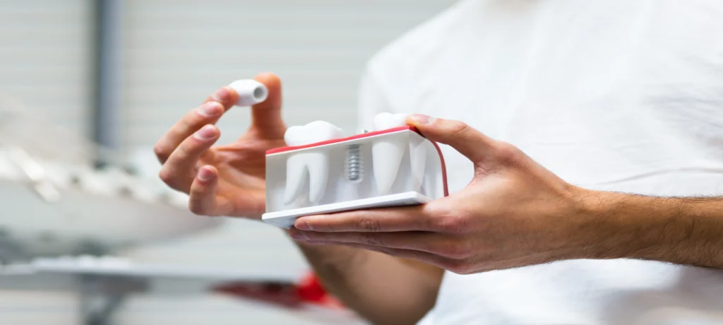 Conseils pré-opératoires