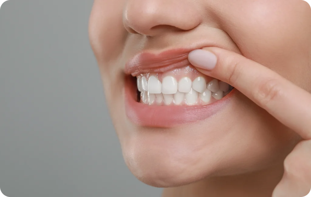 Soins des gencives chirurgicaux