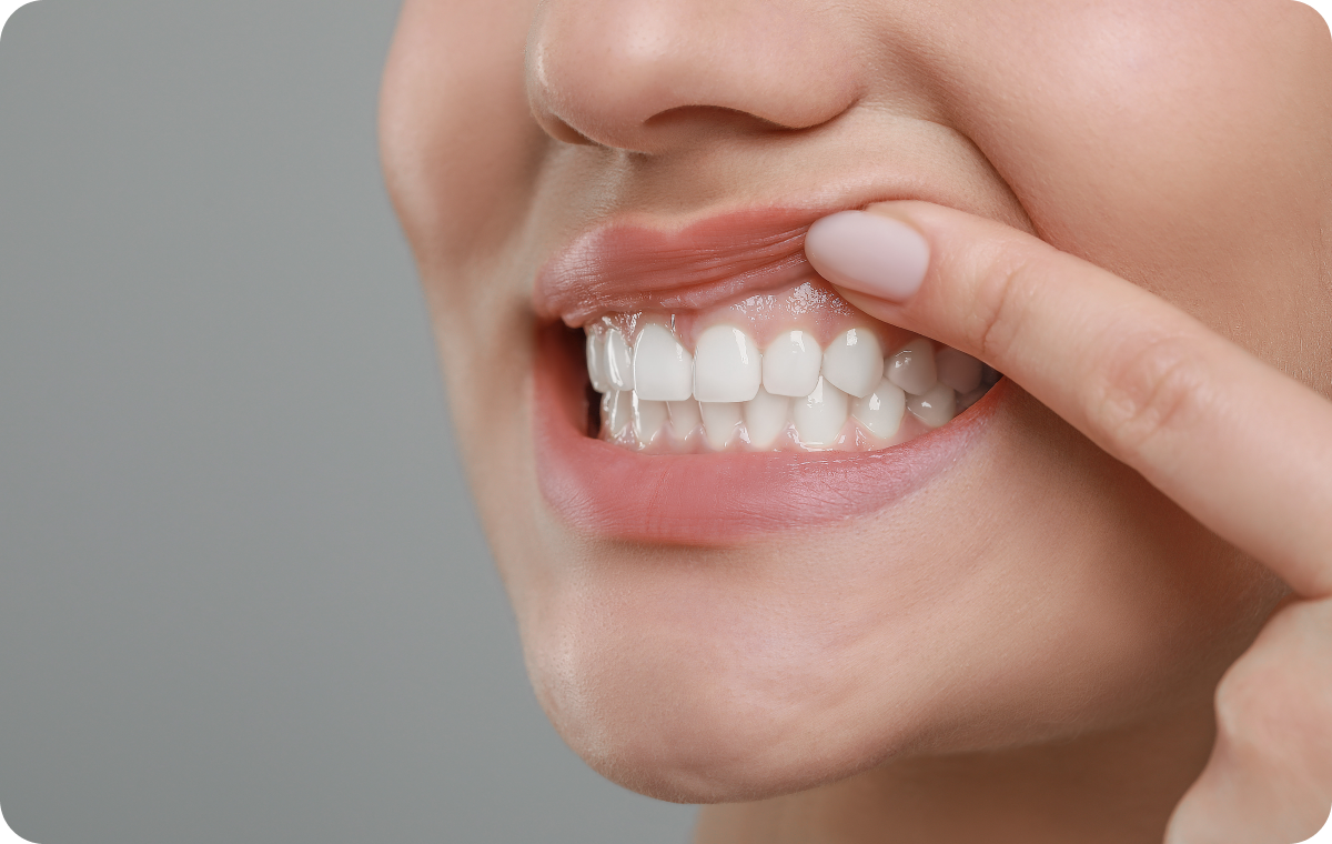 soins gencives chirurgicaux dentiste metz Nos conseils Dentistes à Metz | Esthétique dentaire | Cabinet dentaire des Ormes