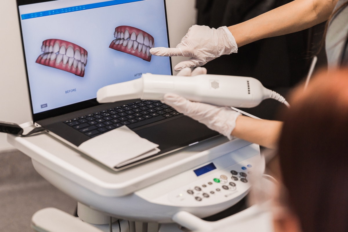 empreinte numerique dentaire metz Nos technologies Dentistes à Metz | Esthétique dentaire | Cabinet dentaire des Ormes