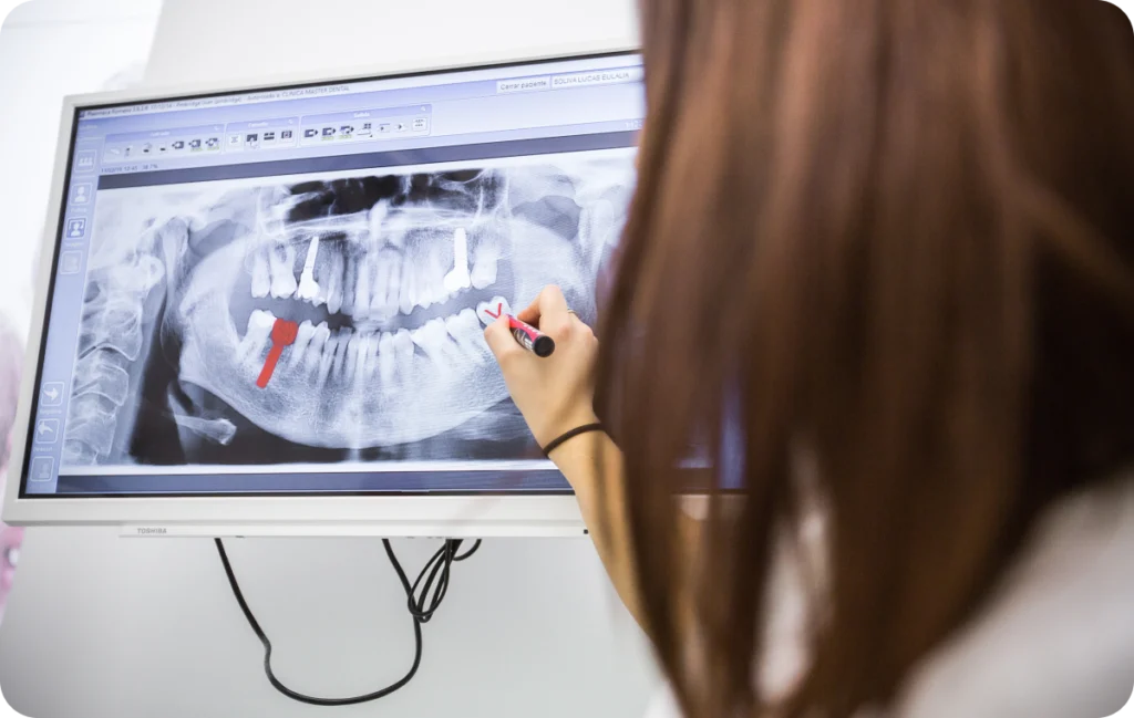 Réhabilitation dentaire globale