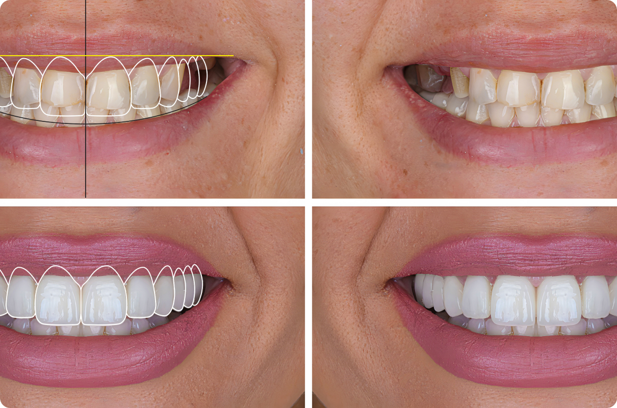 smile cloud metz Nos technologies Dentistes à Metz | Esthétique dentaire | Cabinet dentaire des Ormes